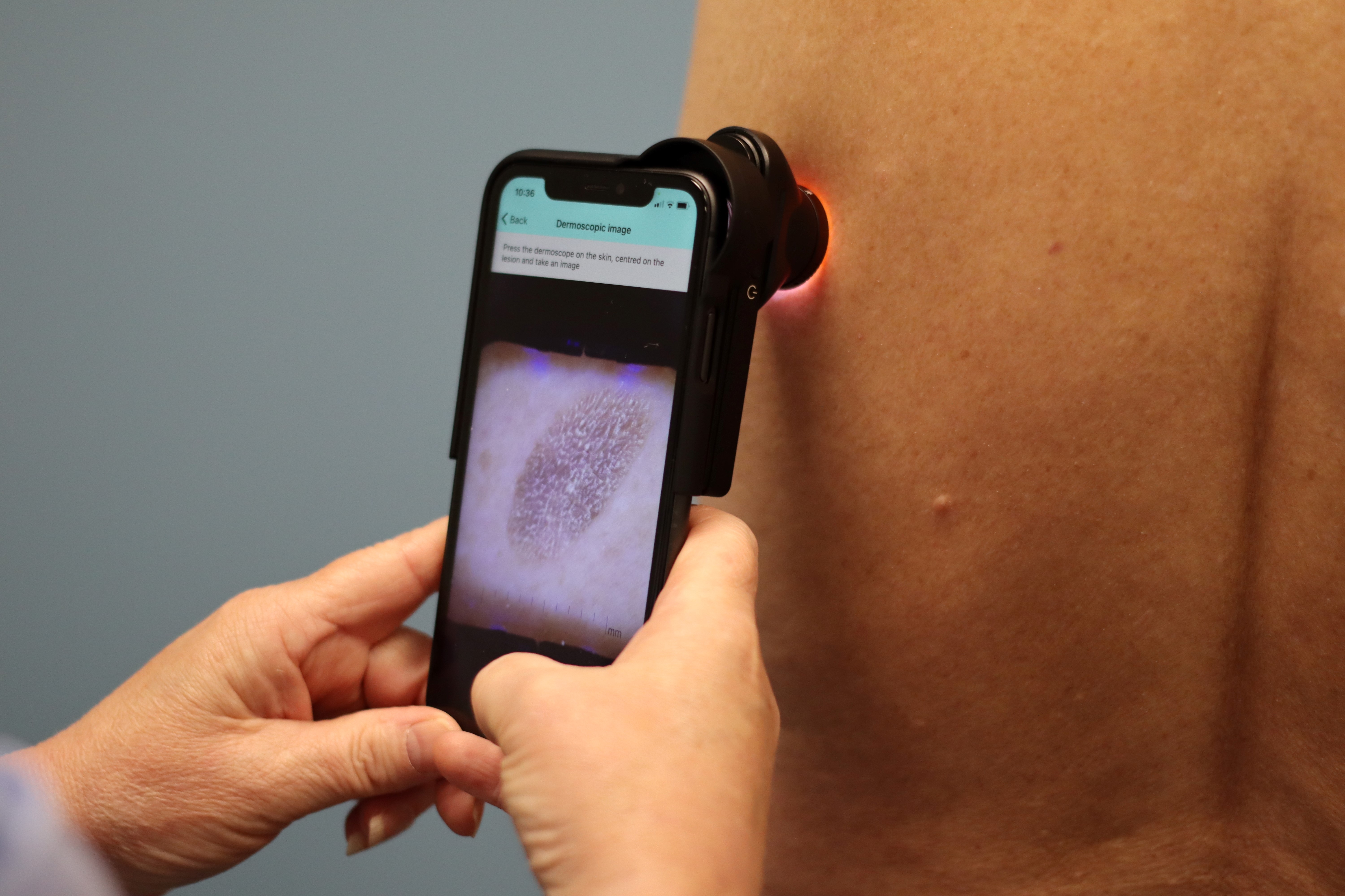 A close up of the AI technology