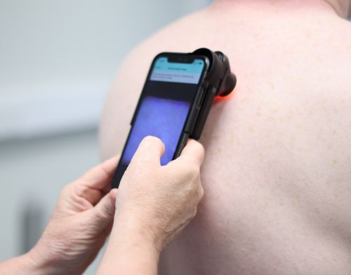 AI Dermatology Service image